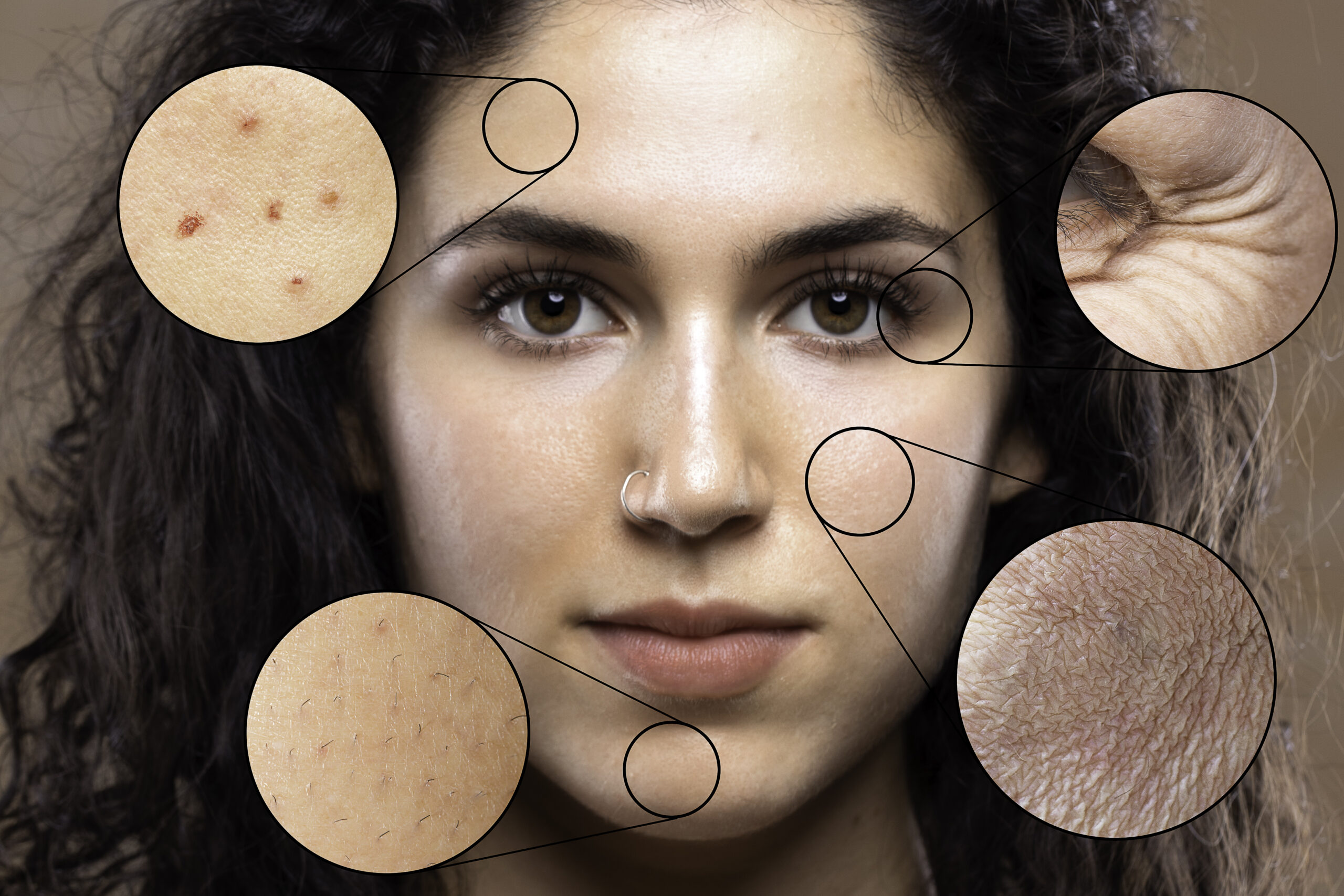 Skin Care Clinic in Rajajinagar