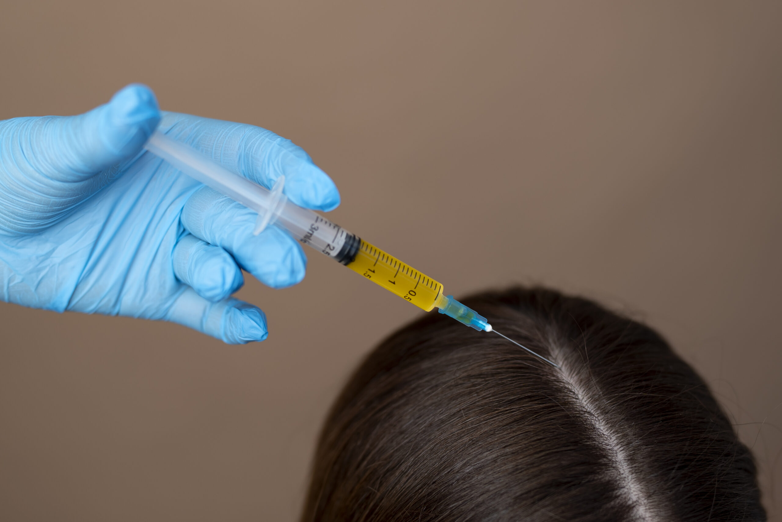 Hair Treatment in Rajajinagar