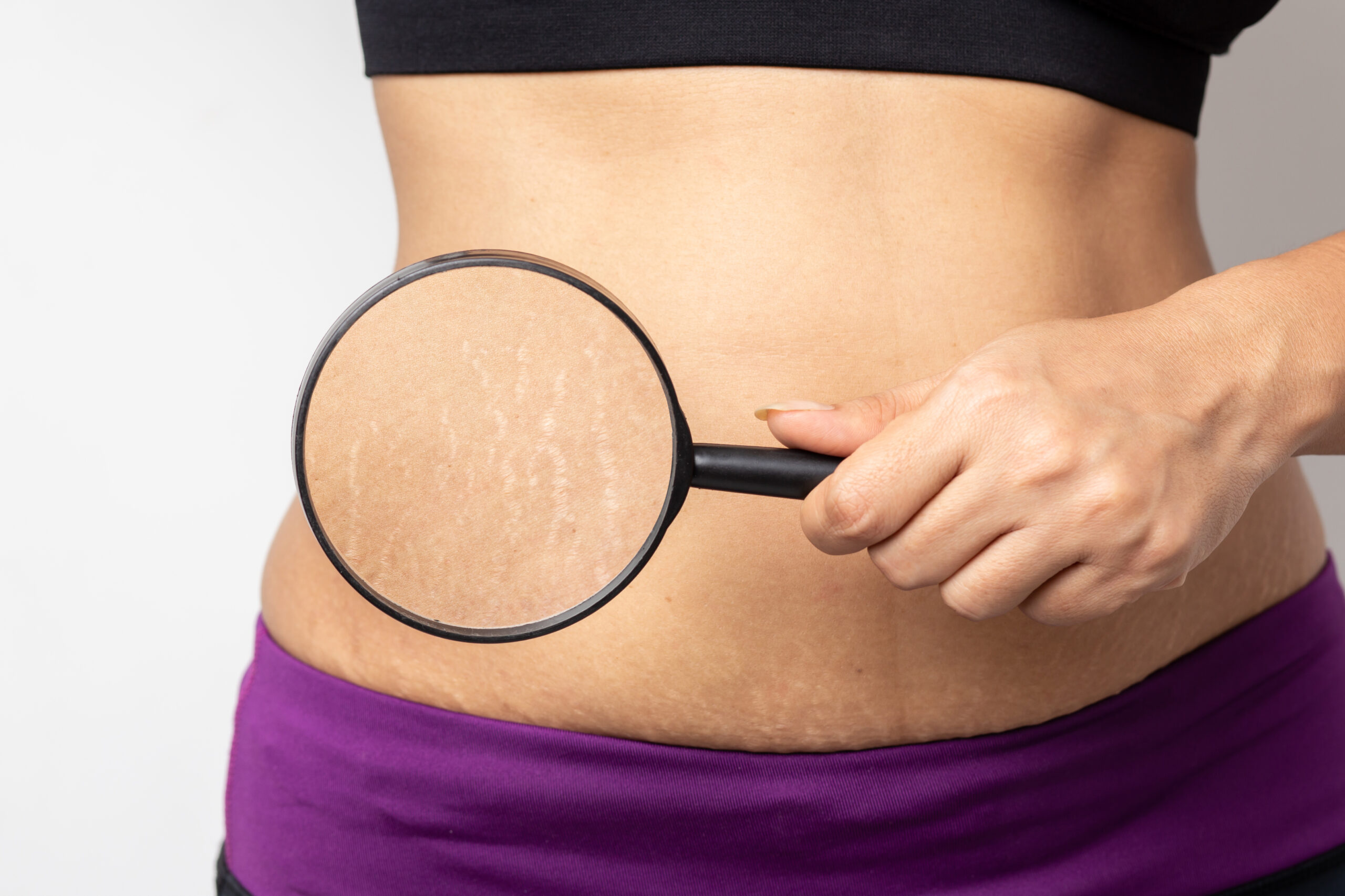 Scars Treatment In Rajajinagar